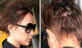 明星有斑秃的吗,明星也难逃斑秃困扰